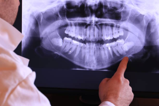 Best Emergency Treatment for Oral Infections in Mission, OR